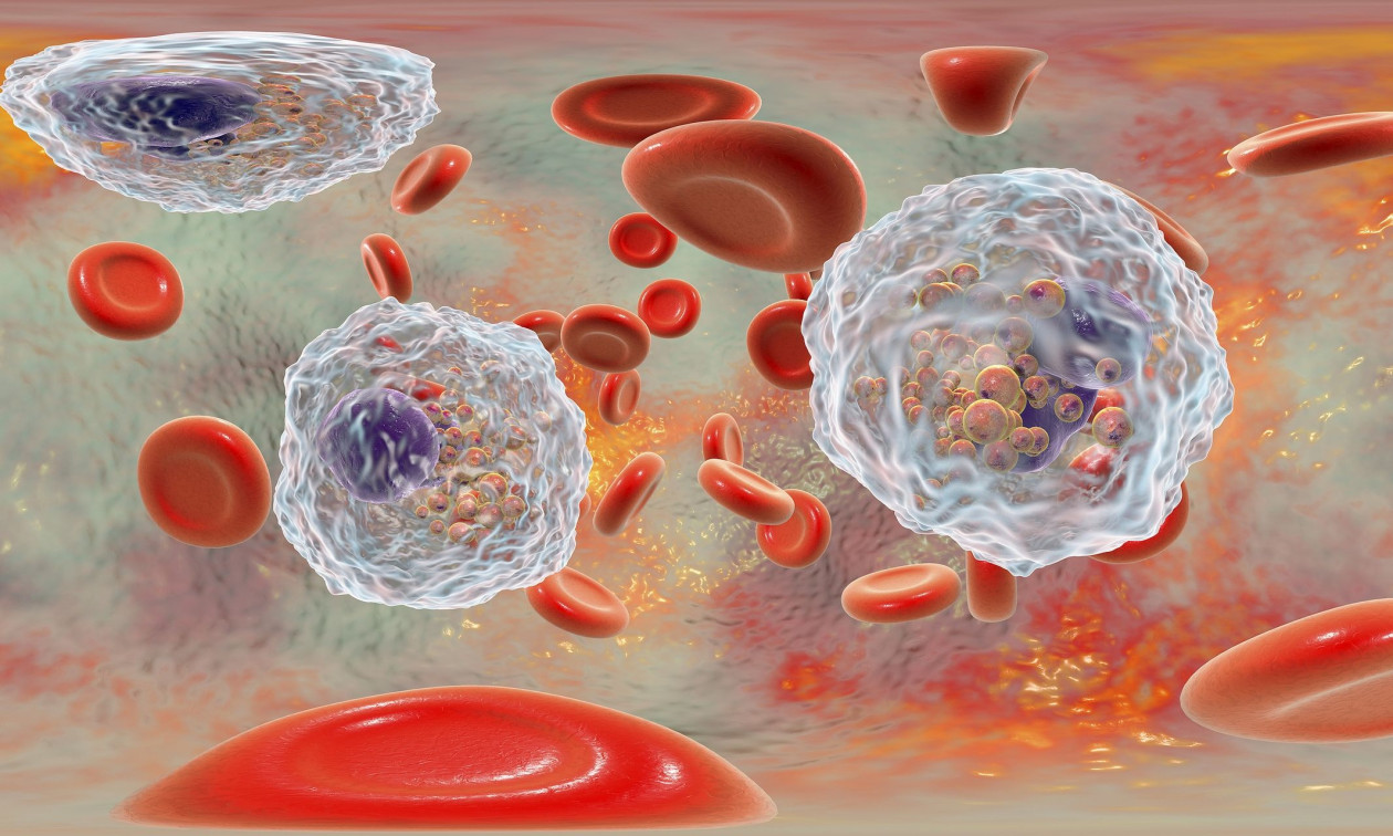 ΥΓΕΙΑ - Μελέτη για τη σχέση των εμβολίων της COVID-19 και νόσων του αίματος - «Ξύπνησε» λανθάνουσα διαραχή; ΥΓΕΙΑ - Μελέτη για τη σχέση των εμβολίων της COVID-19 και νόσων του αίματος - «Ξύπνησε» λανθάνουσα διαραχή;