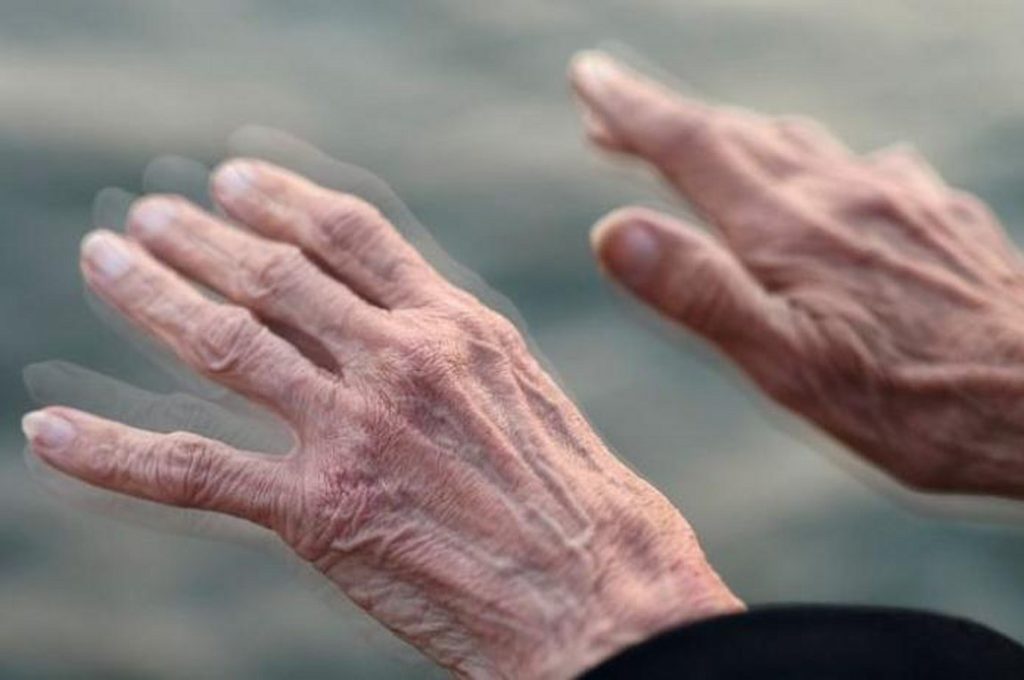 Στ. Χατζηγεωργίου, νευρολόγος: Ανησυχητική η αύξηση πάρκινσον στη Θεσσαλία-(video) Στ. Χατζηγεωργίου, νευρολόγος: Ανησυχητική η αύξηση πάρκινσον στη Θεσσαλία-(video)